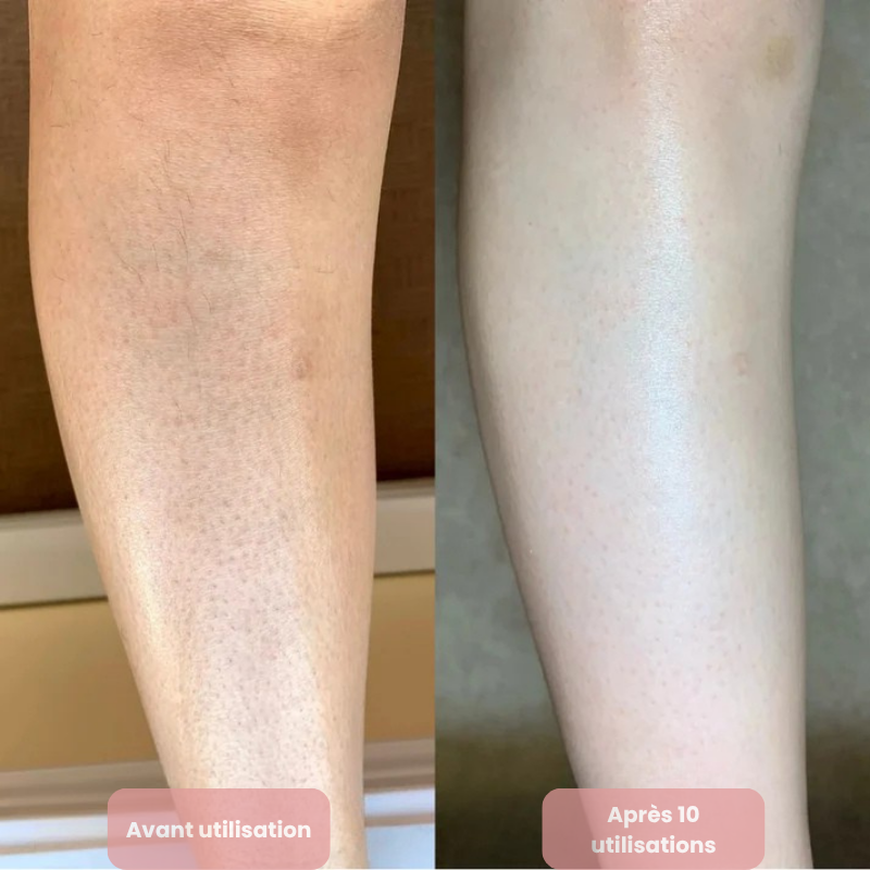 Crème Exfoliante & Resurfaçante  Douceur Éclat Lisséa™