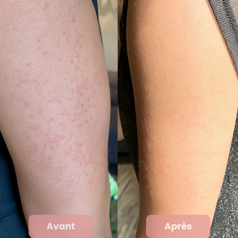 Crème Exfoliante & Resurfaçante  Douceur Éclat Lisséa™